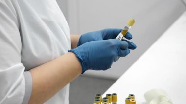 Laboratuvar teknisyenlerinin eldiven giyip laboratuarda tıbbi analiz için kan plazması ya da idrar örneğiyle test tüpüne barkod etiketi yapıştırmalarını kapatın..