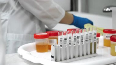 Mavi eldivenli bir tıp laboratuarı çalışanı modern sağlık laboratuarında klinik teşhis ve laboratuvar analizi için idrar örneklerini test tüplerine döküyor..