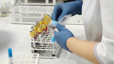 Laboratuvar teknisyenlerinin laboratuvar ortamında klinik testler için gelen kan örneklerini sınıflandırması..