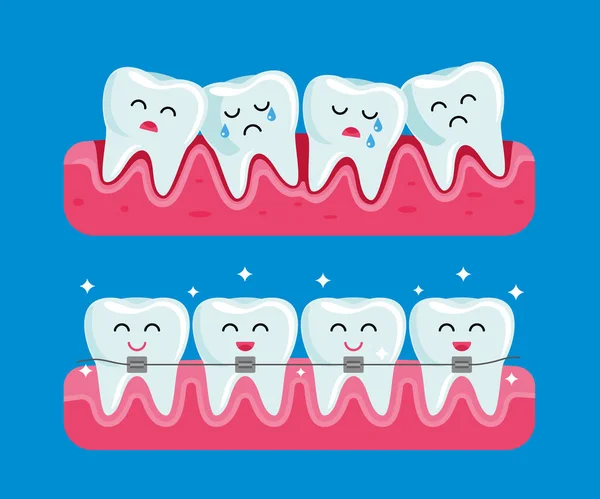 Dientes antes y después de aparatos ortopédicos. ilustración dental divertida en estilo de dibujos animados — Vector de stock