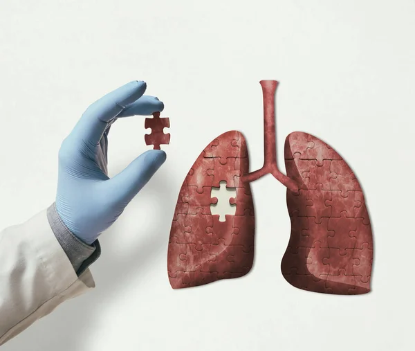 Головоломка Ілюстрацією Людських Легенів Докторською Рукою Відсутнім Шматочком Головоломки Концепція — стокове фото