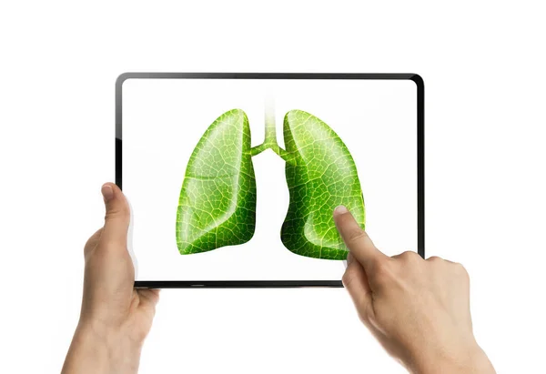 Ręka Dotyka Płuc Ekranie Laptopa Konsultacje Online Wyniki Badań Lekarskich — Zdjęcie stockowe