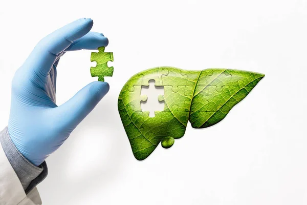 Puzzle Con Ilustración Hígado Verde Mano Del Médico Con Pieza — Foto de Stock