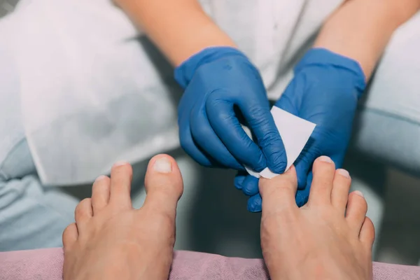 Pedicure process in salon. Foot care treatment and nail. Degreasing nails with a cloth and solution. Master in blue gloves makes pedicure with manicure machine. Concept of beauty care and health.