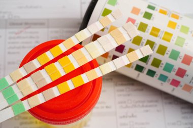 İdrar tahlili, reaksiyonlu idrar kabı. PH kağıt testi ve karşılaştırma tablosu laboratuvarda..