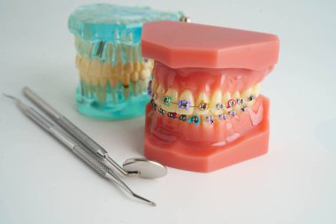 Diş sağlığı tedavisinde kullanılan dişçi aracına sahip diş modeli.