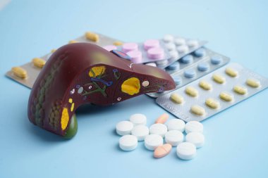 Hap tedavisi gören karaciğer modeli, siroz, karaciğer kanseri, yağlı karaciğer..