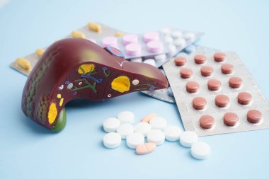 Hap tedavisi gören karaciğer modeli, siroz, karaciğer kanseri, yağlı karaciğer..