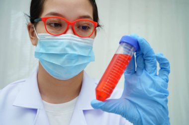 Doktor tiroid bezi modeli ve kan örneği tüpünü laboratuarda tutuyor..