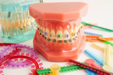 Ortodontik bağlar halkalar ve kravatlar, diş hekimliği üzerine çalışan dişçi için model..