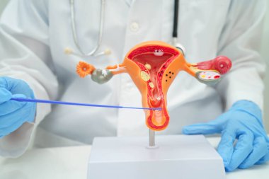 Rahim, hastanede teşhis ve tedavi için insan anatomisi modeli tutan doktor..