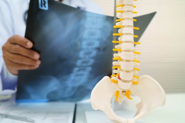 Doktor omurga röntgen filmini inceliyor..