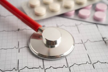 Elektrokardiyogram, EKG, kalp dalgası, kalp krizi, kardiyogram raporu.