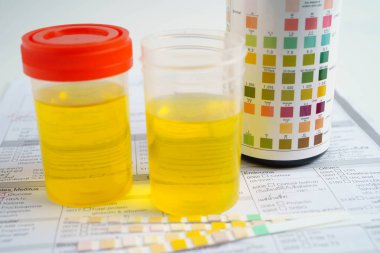 İdrar tahlili, laboratuarda sağlık kontrolü için idrar kabı..