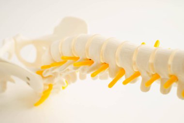 Omurga ve kemik, bel kemiği yerinden oynamış disk parçası, ortopedi bölümünde tedavi için model..