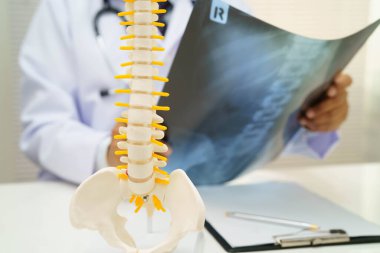 Doktor omurga röntgen filmini inceliyor..