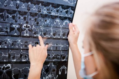 Doktor. Siyah üniformalı, uzun sarı saçlı beyaz bir kadın, elinde kafasının MR taramasını tutuyor.