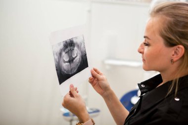 Sarışın beyaz dişçi kız çenenin röntgenine bakıyor.