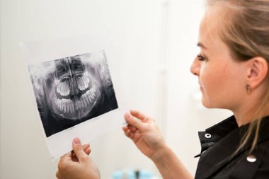 Sarışın beyaz dişçi kız çenenin röntgenine bakıyor.