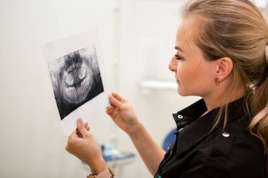 Sarışın beyaz dişçi kız çenenin röntgenine bakıyor.