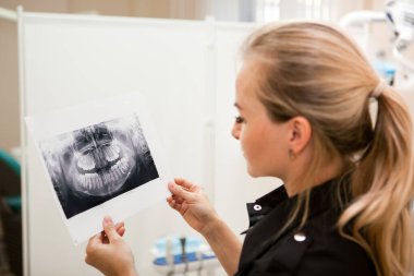 Sarışın beyaz dişçi kız çenenin röntgenine bakıyor.