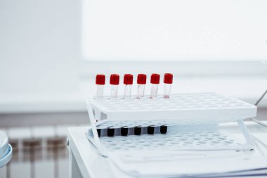 Parlak ofisteki tezgahın üzerinde kan olan test tüpleri.