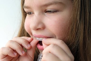 Çocuğun dişlerinin üzerine düzgün dizilim koyması, basit ortodontik rutinleri ve günlük diş bakımını gösteriyor. Sağlık hizmeti içeriği, hizalama dersleri ve modern dişçilik pazarlaması