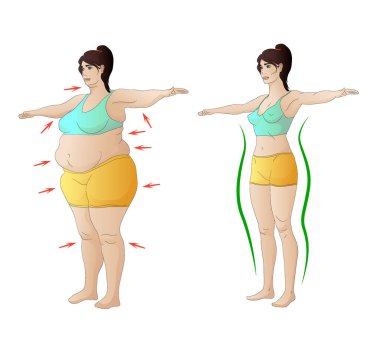 Diyet öncesi ve sonrası oklarla ve doğrusal tanımlamayla obezite ve zayıf kadın karşılaştırması