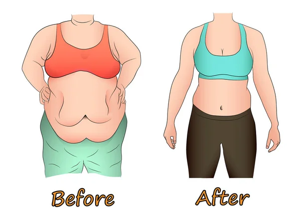 ダイエット スポーツ 手術の前と後の女性の腹部の脂肪 — ストックベクタ