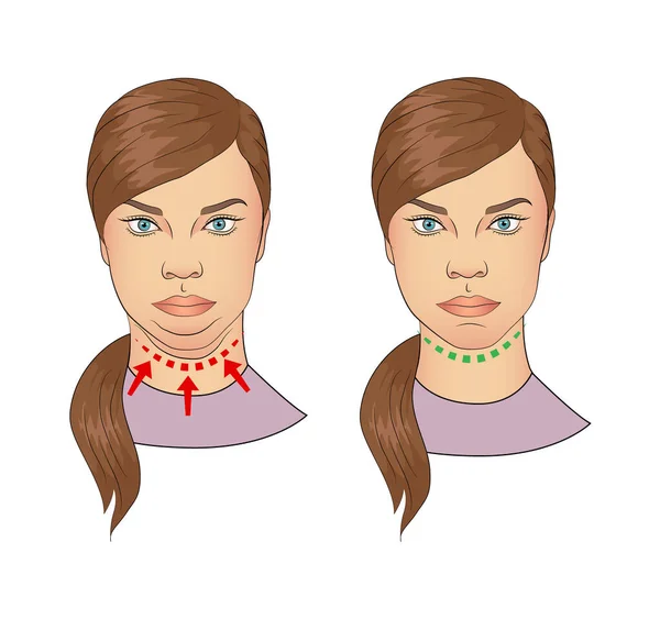 Mujer Con Sin Barbilla Doble — Vector de stock