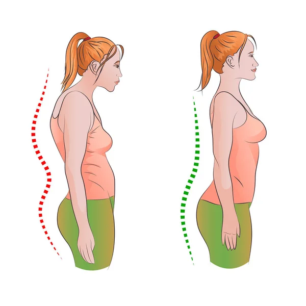 Mujer Con Postura Espalda Derecha Equivocada — Vector de stock