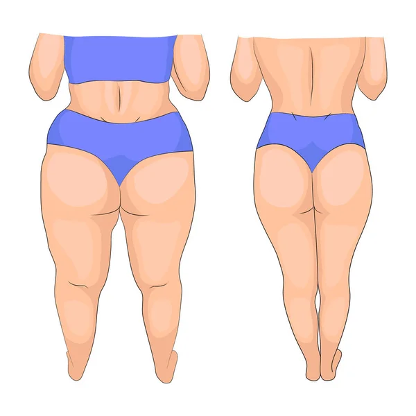 Mujer Ropa Interior Azul Antes Después Del Entrenamiento Dieta Liposucción — Vector de stock