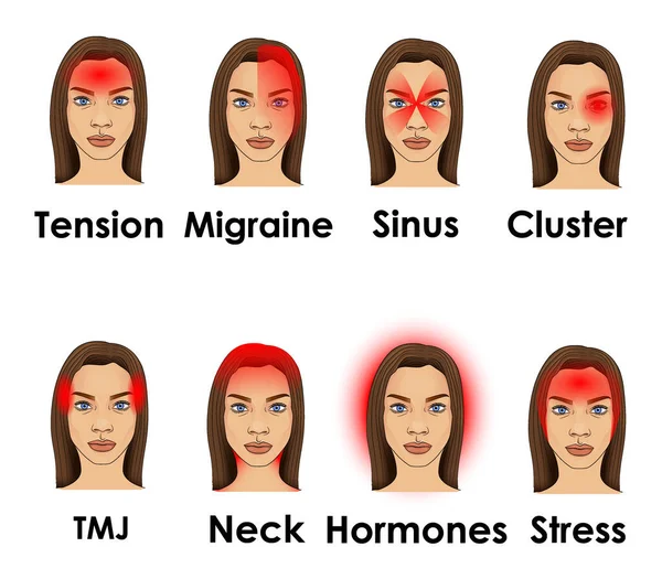 Tipos Dor Cabeça Ilustrada Rosto Uma Mulher —  Vetores de Stock