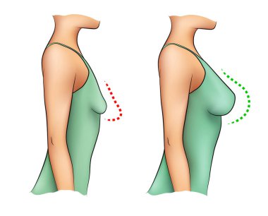 Beyaz arka planda küçük ve büyük göğüslü bir kadın.