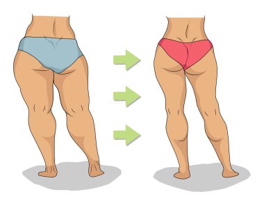 Butt and legs of thick and slim woman