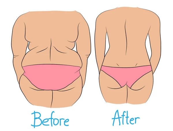 体重減少前と後の女性の背脂 — ストックベクタ