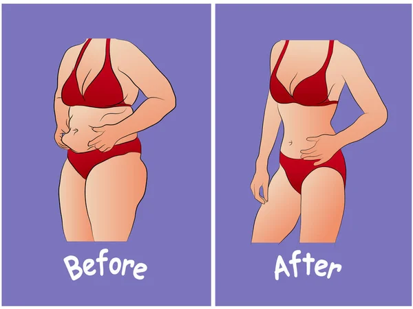 スリムな女性と比較して脂肪腹の赤い下着の女性 食事の前後の女性の体 — ストックベクタ