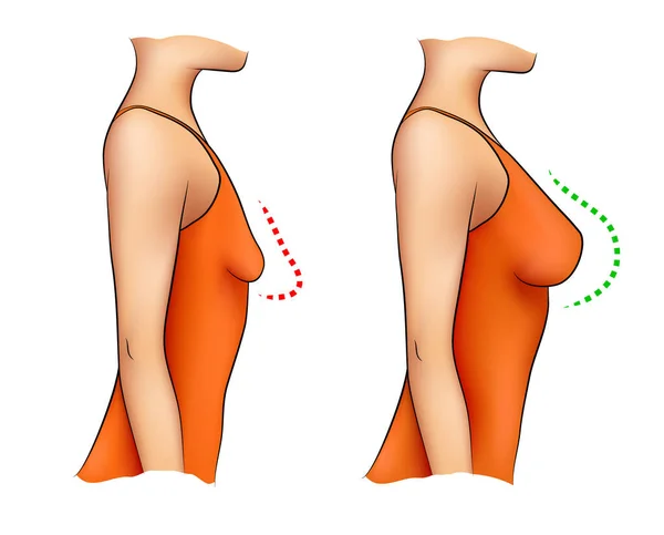 Mulher Com Seios Pequenos Grandes Fundo Branco Ilustração De Stock