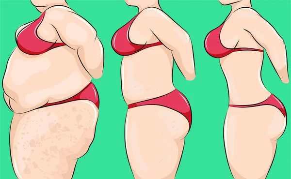 Desenhos Animados Ilustrados Corpo Mulher Mudando Excesso Peso Para Magro Vetores De Stock Royalty-Free