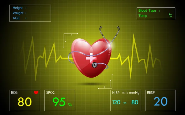 Schermo cardiografico medico ecg — Vettoriale Stock