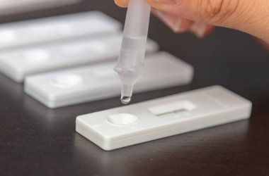 Hızlı antijen test kiti, cihaza tüp bırakma örneği. Covid19 Coronavirus laboratuvar tespiti. Adam kendini test ediyor. Yakın görünüm
