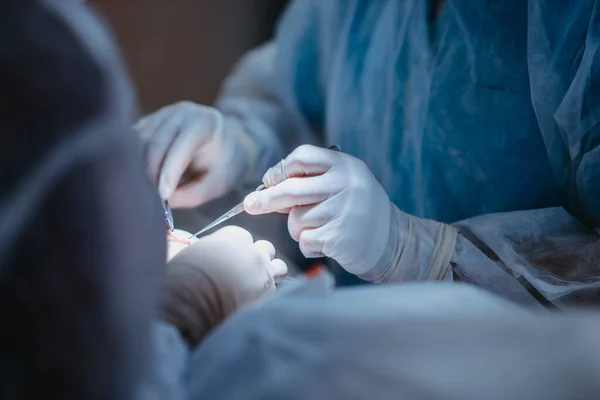 Χέρια Χειρουργών Που Χειρίζονται Ασθενή Νευροχειρουργική — Φωτογραφία Αρχείου