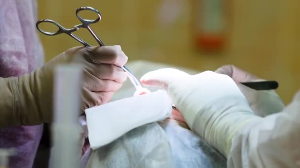 Chirurgie Plastică Feței Mâinile Chirurgilor Asistenților Sala Operație — Videoclip de stoc