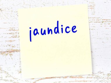 Sarılığı hatırlatma kavramı. Tahta duvarda üzerinde yazı olan sarı yapışkan kağıt.