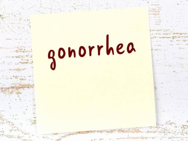 Tahta duvarda el yazısıyla yazılmış bel soğukluğu olan sarı yapışkan bir not.