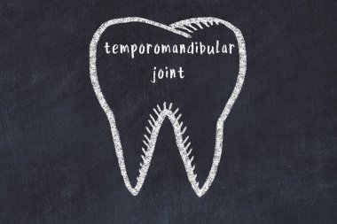 Tıbbi terimi temporomandibular eklem olan bir dişin tebeşir çizimi. Stomatoloji öğrenme kavramı.