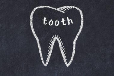 Tıbbi tabirle diş tebeşiri çizimi. Stomatoloji öğrenme kavramı.