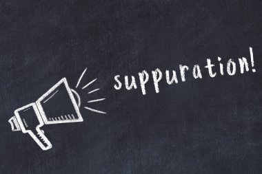 Hoparlörün tebeşir çizimi ve siyah masanın üzerine el yazısıyla yazılmış yazması.