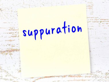 Tahta duvarda el yazısıyla yazılmış sarı yapışkan bir not var.