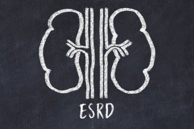 Chalk drawing of human kidneys and medical term ESRD. Concept of learning medicine. clipart